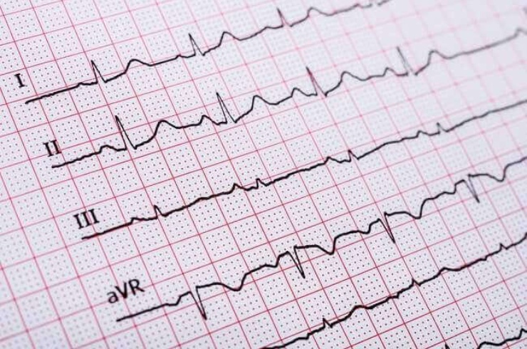 ECG and Respiratory Analysis